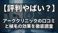 【評判やばい？】アーククリニックの口コミと植毛の効果を徹底調査